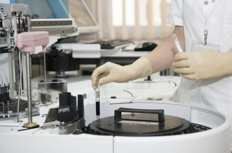 Da li brže stižu negativni ili pozitivni testovi na koronavirus
