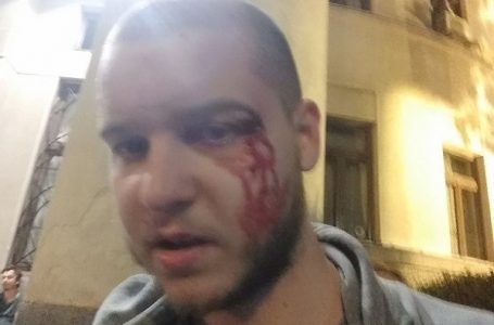 UNS: Za pet dana napadnuto i ometano u radu 28 novinara i medijskih radnika