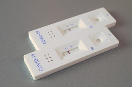 Registrovano još 30 novoobolelih od koronavirusa, među pozitivnima i sedmoro dece
