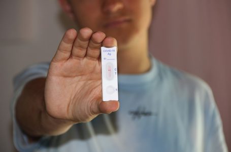 Koronavirus registrovan kod još 36 osoba