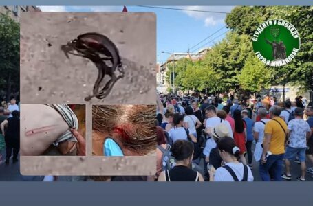 Student iz Gornjeg Milanovca povređen tokom protesta u Beogradu